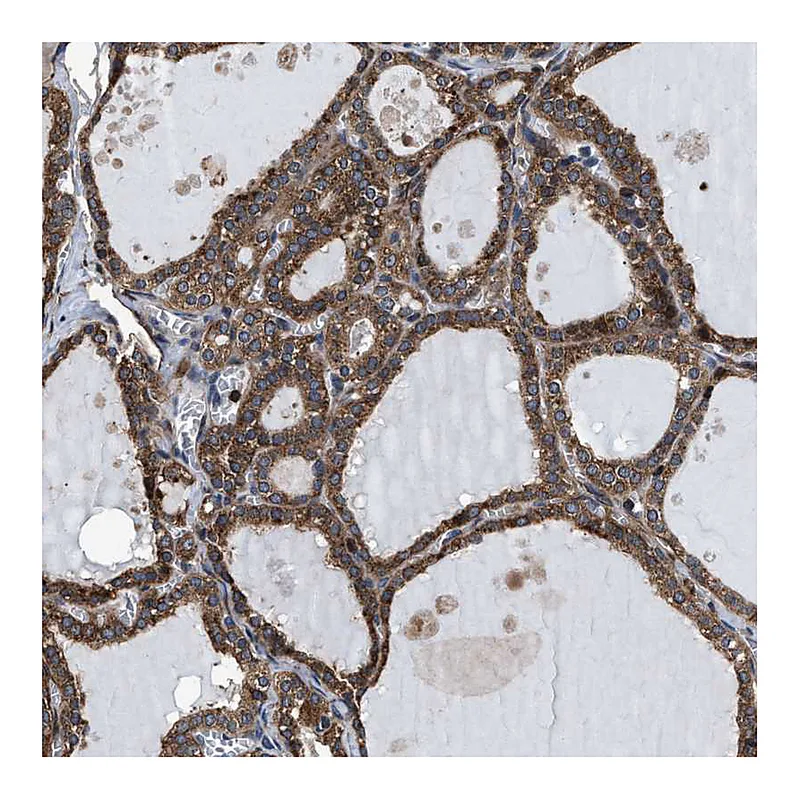 Atlas Antibodies Anti-MRPS30 Antibody