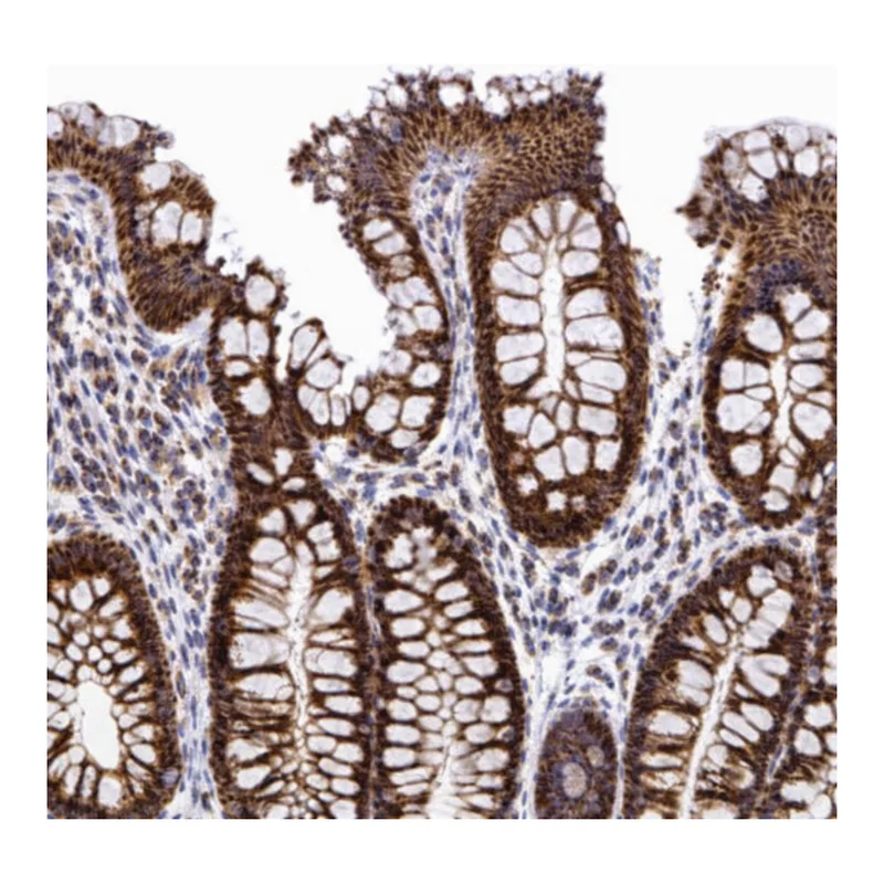 Atlas Antibodies Anti-MRPS26 Antibody