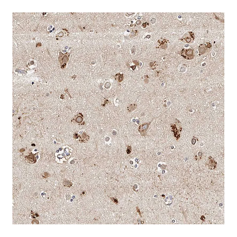 Atlas Antibodies Anti-MRPS33 Antibody