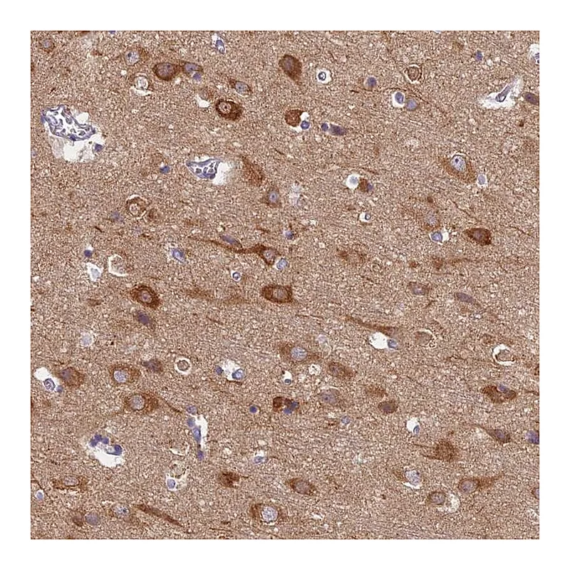 Atlas Antibodies Anti-MRPS25 Antibody