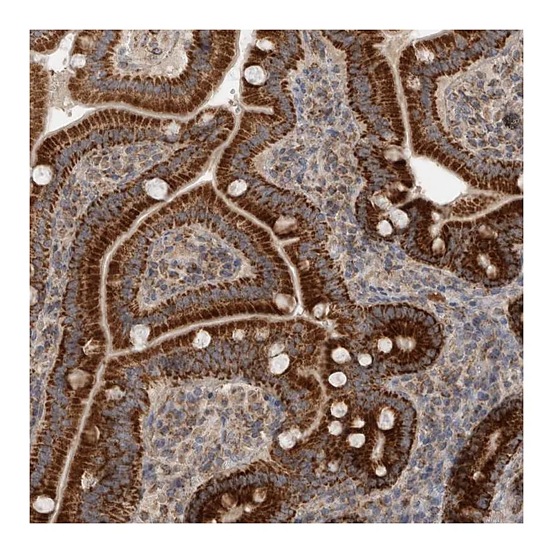 Atlas Antibodies Anti-MRPS28 Antibody