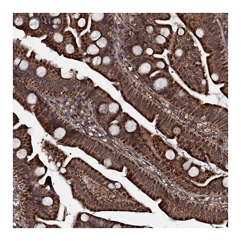Atlas Antibodies Anti-MRPS31 Antibody