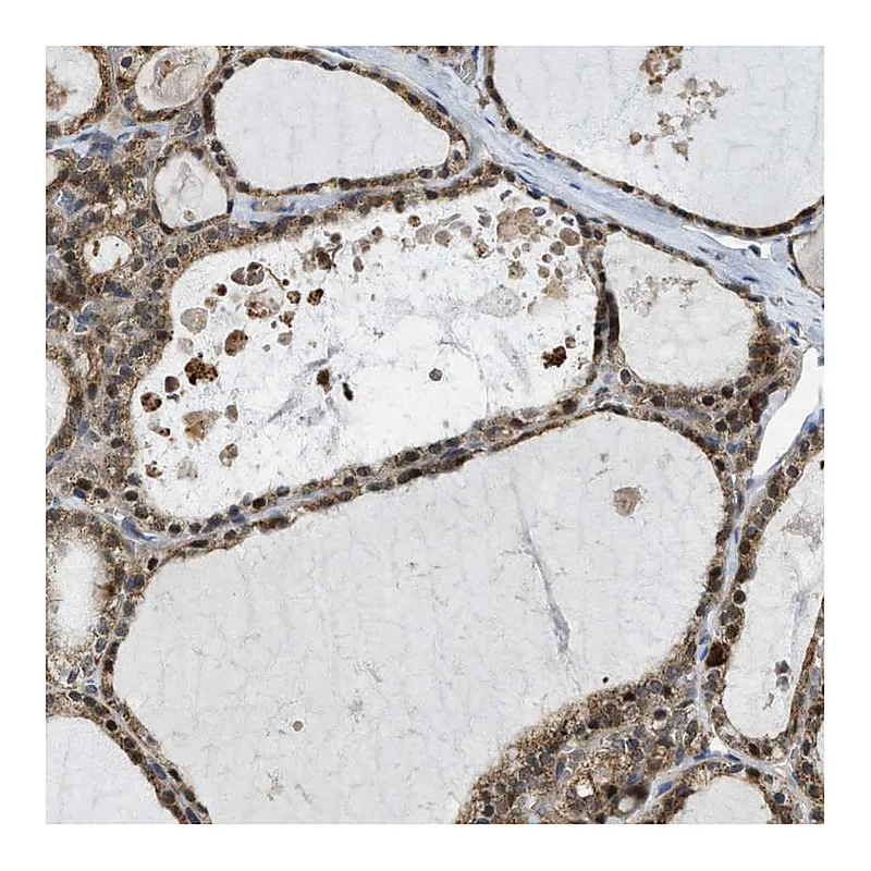Atlas Antibodies Anti-MRPS30 Antibody
