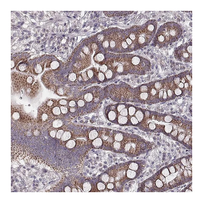 Atlas Antibodies Anti-MRPS27 Antibody