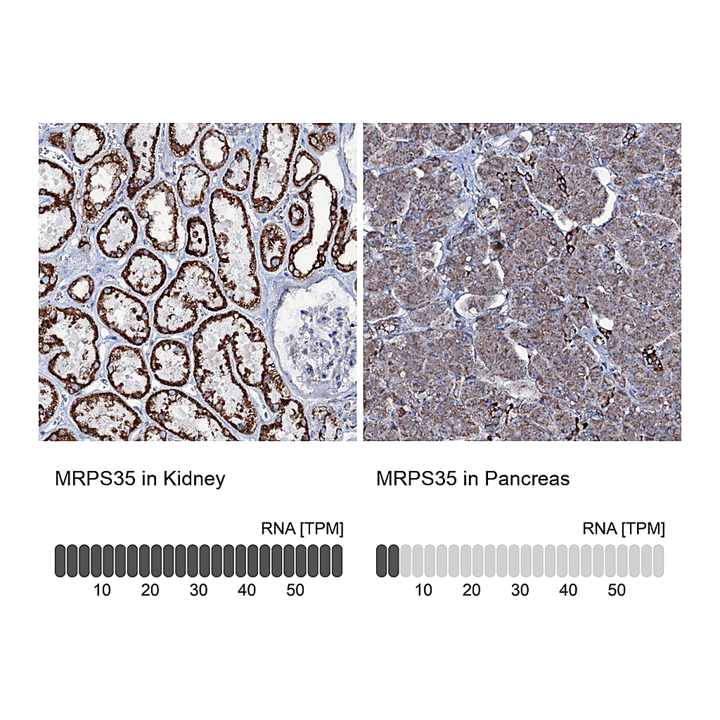 Atlas Antibodies Anti-MRPS35 Antibody