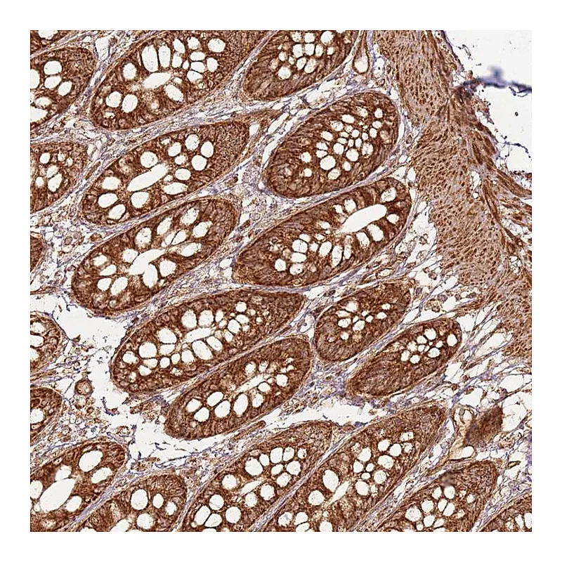 Atlas Antibodies Anti-MRPS6 Antibody