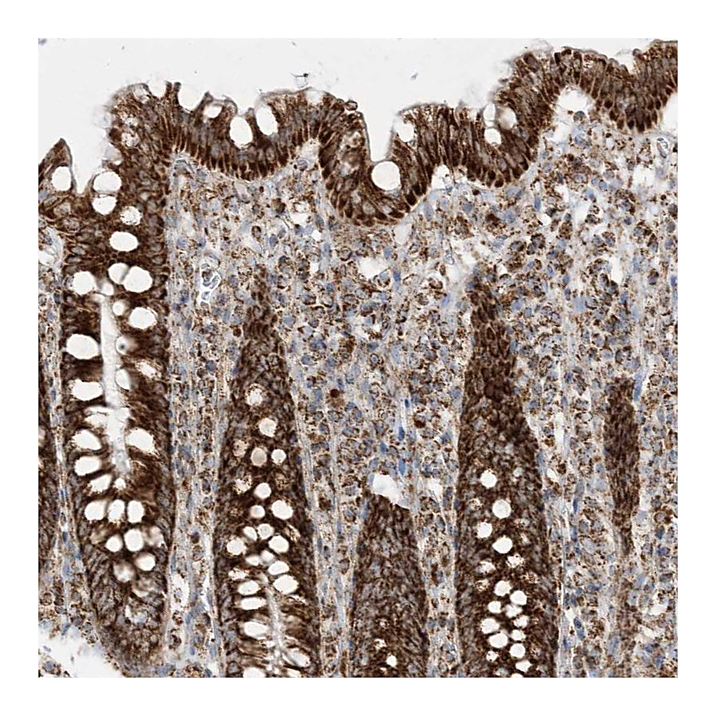 Atlas Antibodies Anti-MRPS36 Antibody