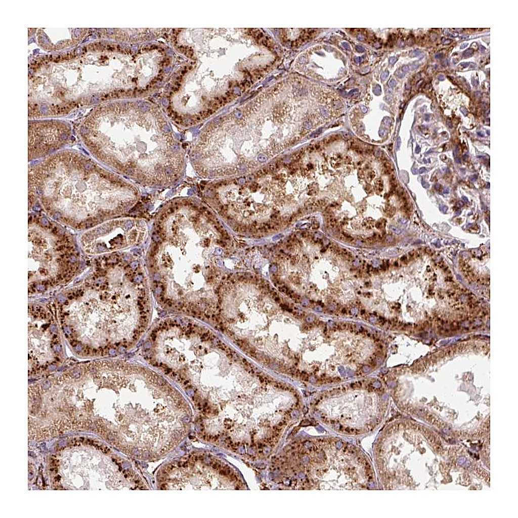 Atlas Antibodies Anti-MRPS5 Antibody