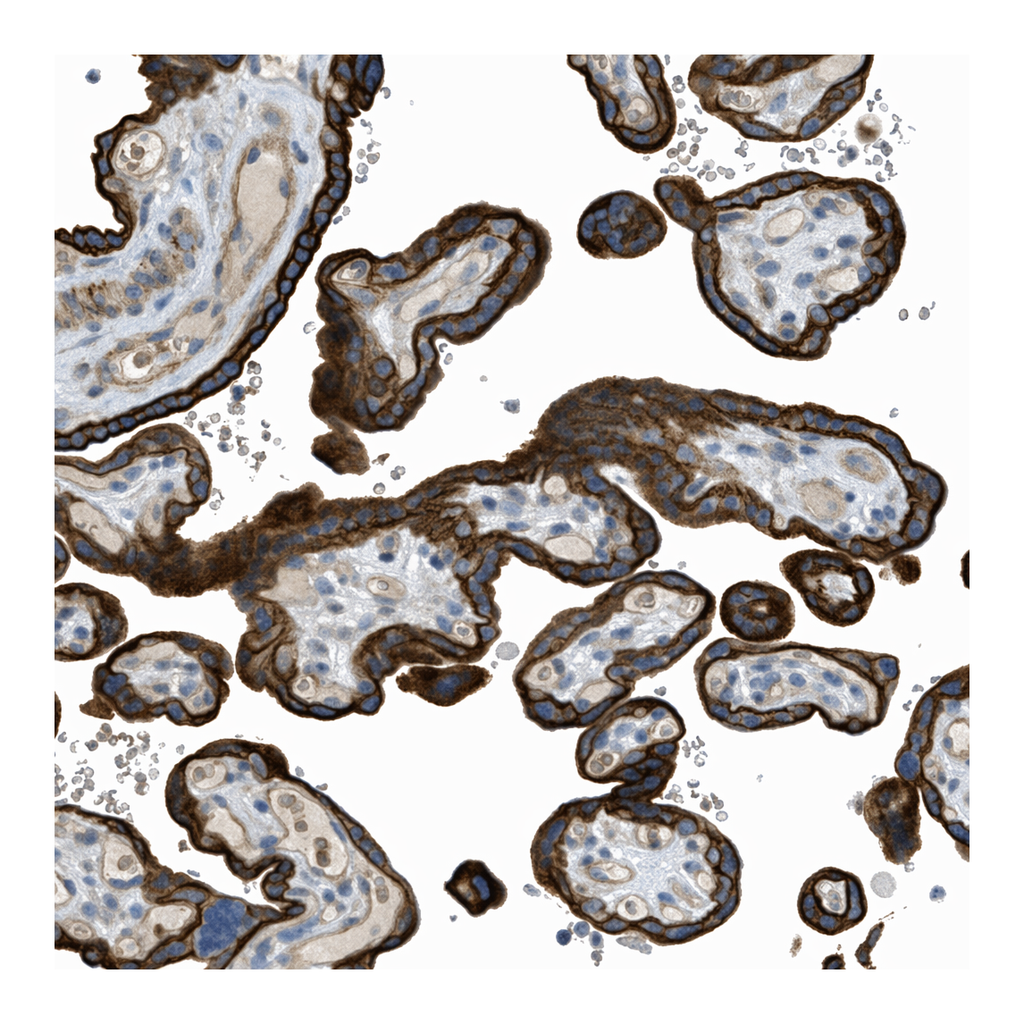 Atlas Antibodies Anti-MRS2 Antibody