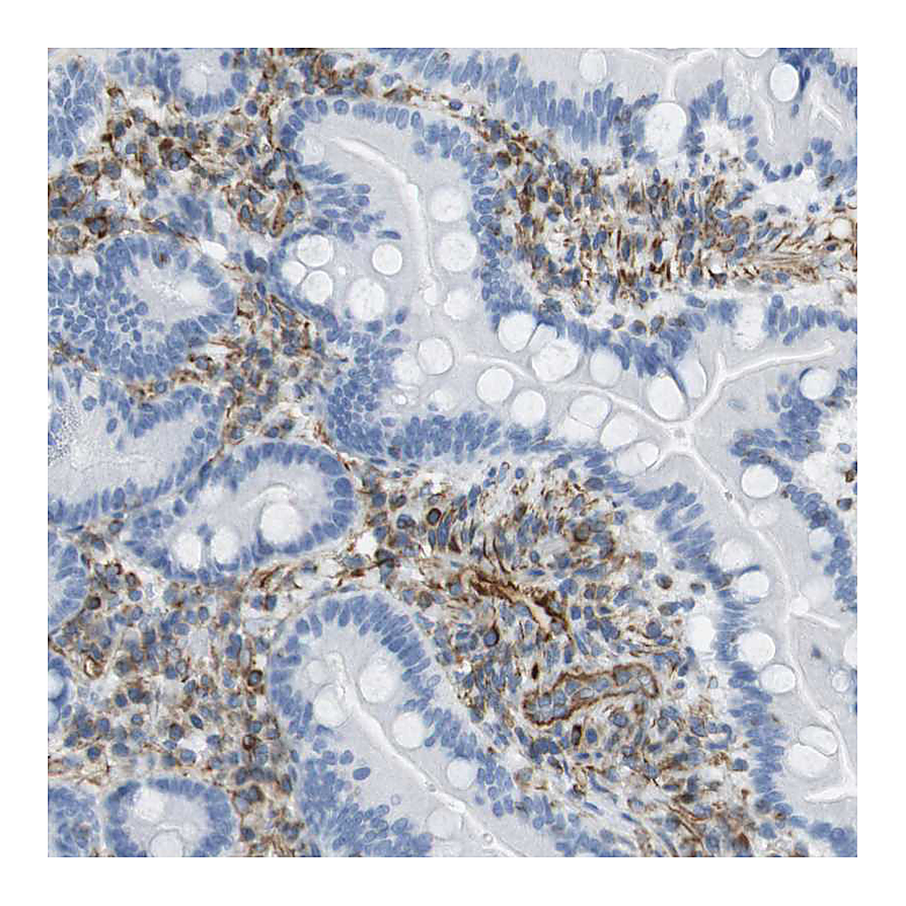 Atlas Antibodies Anti-MS4A10 Antibody