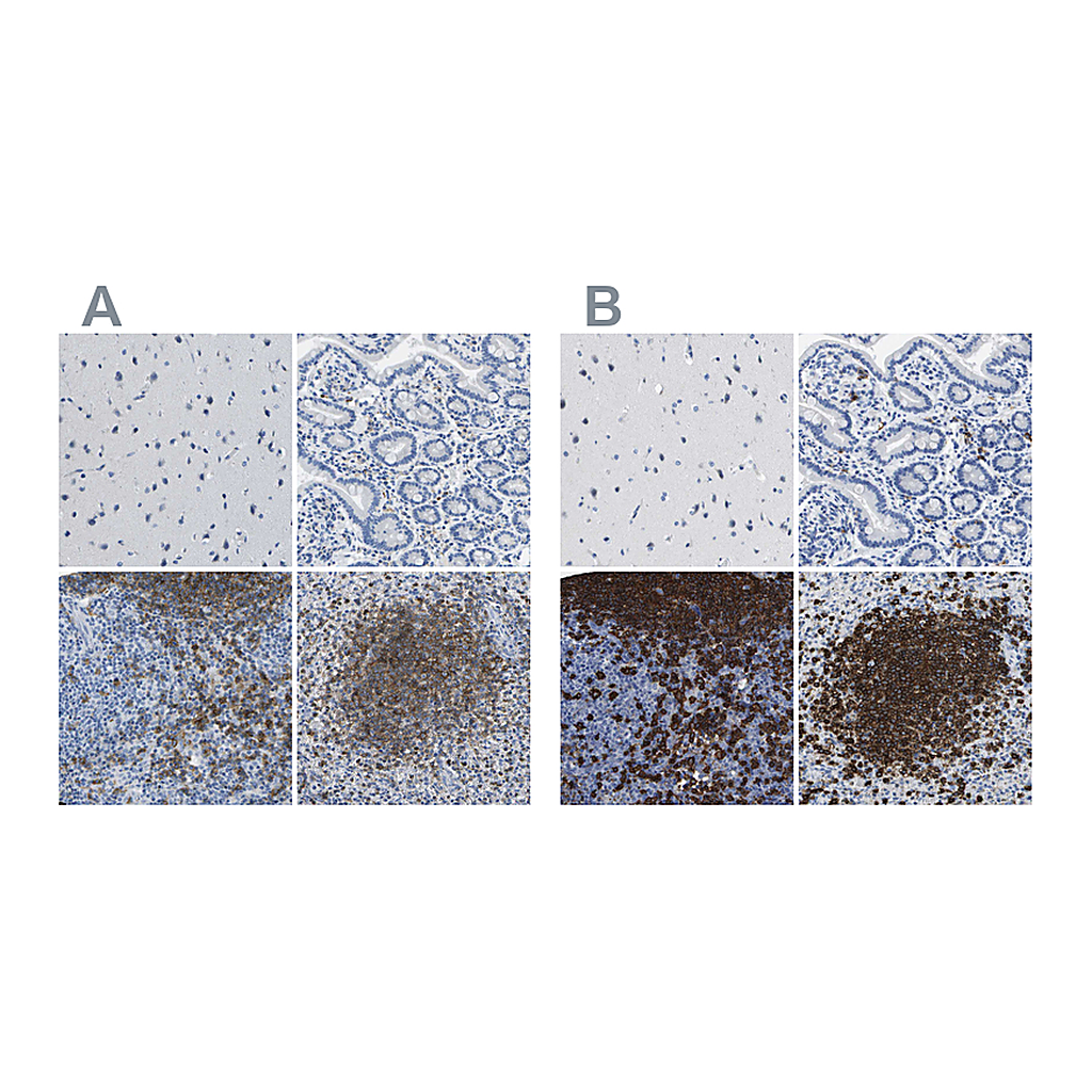 Atlas Antibodies Anti-MS4A1 Antibody