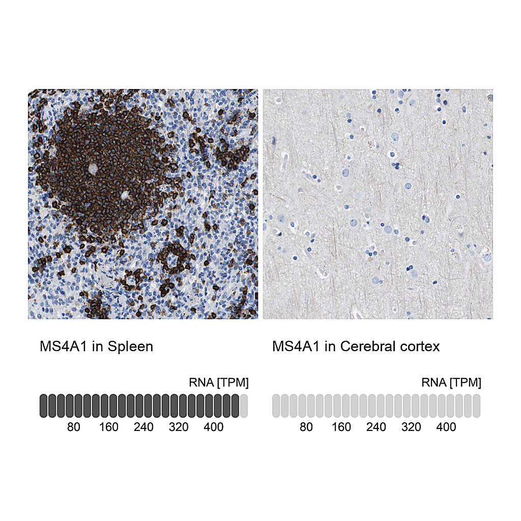 Atlas Antibodies Anti-MS4A1 Antibody