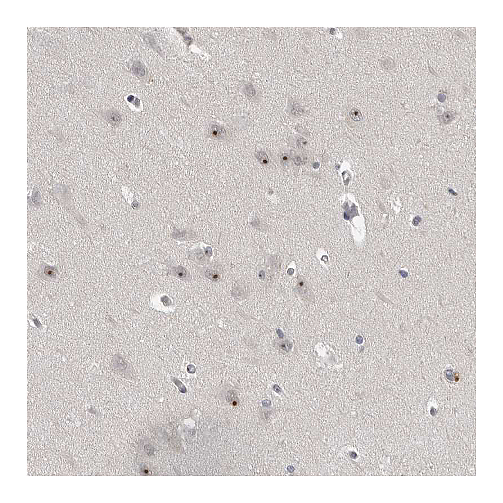 Atlas Antibodies Anti-MRTO4 Antibody