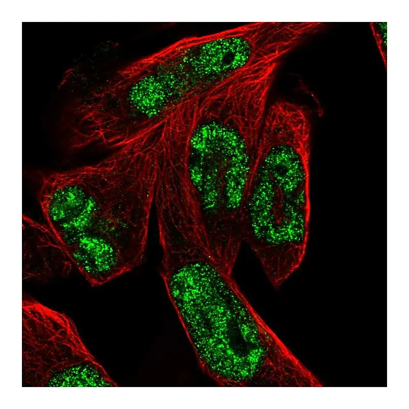 Atlas Antibodies Anti-MSANTD3 Antibody