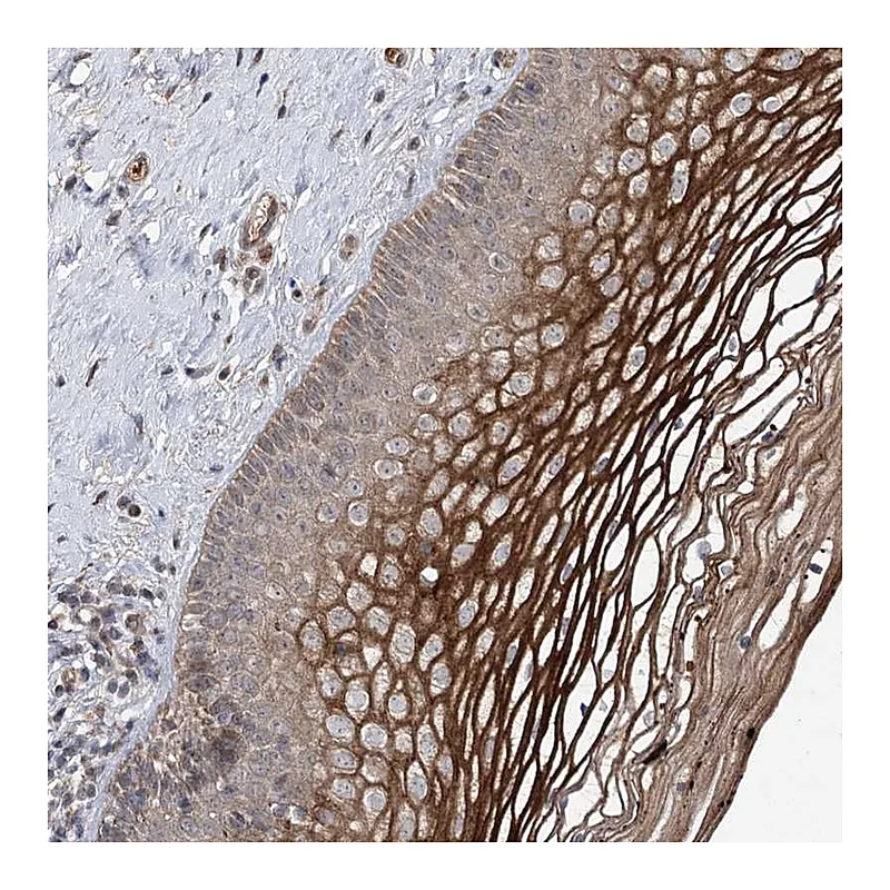 Atlas Antibodies Anti-MSANTD2 Antibody