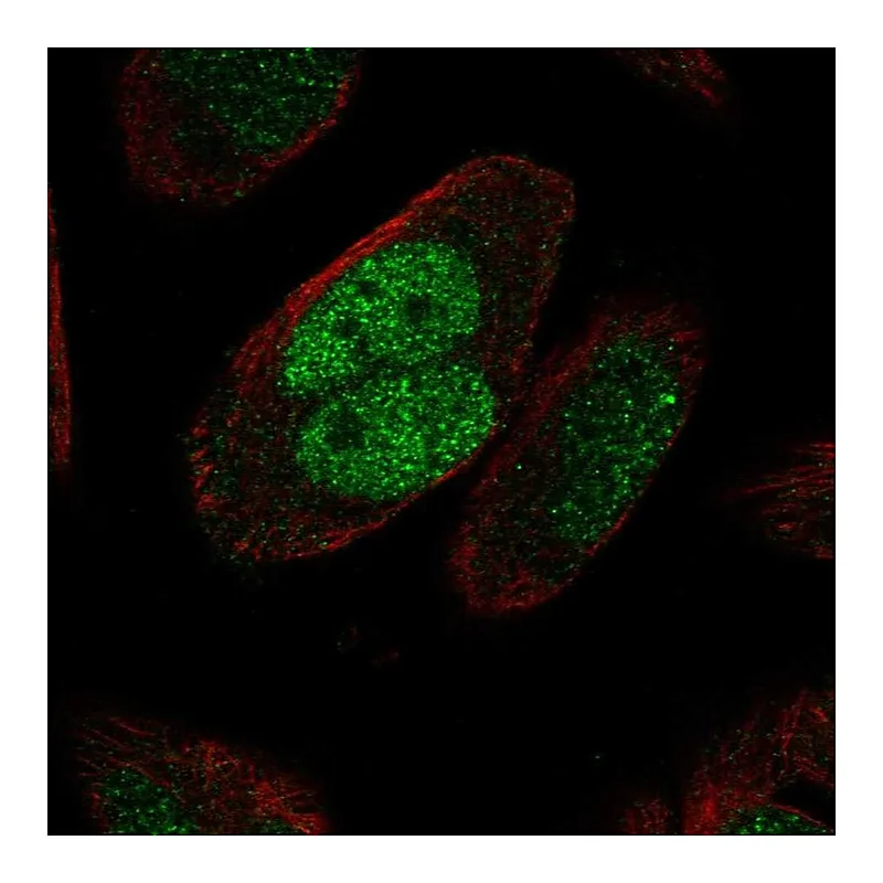 Atlas Antibodies Anti-MSH2 Antibody