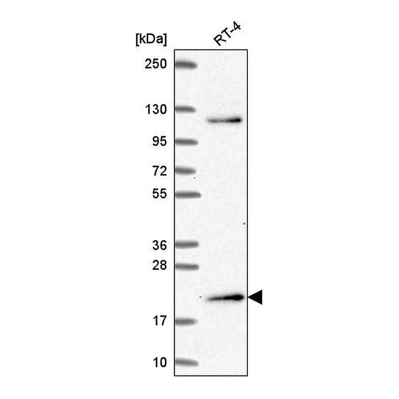 Atlas Antibodies Anti-MSC Antibody