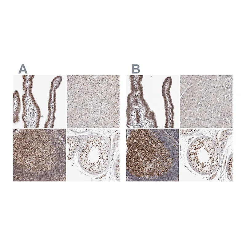 Atlas Antibodies Anti-MSH6 Antibody