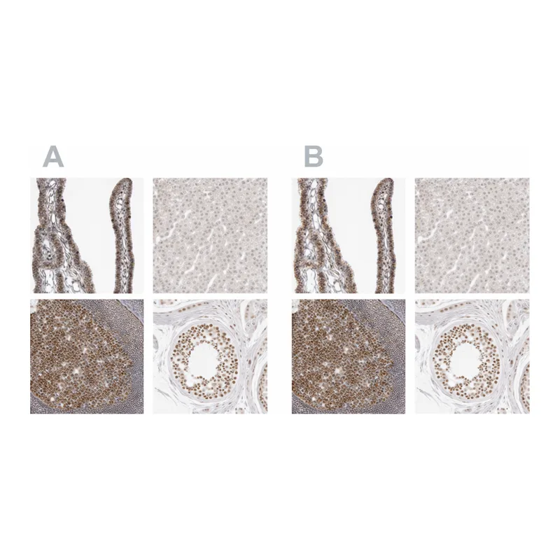 Atlas Antibodies Anti-MSH6 Antibody