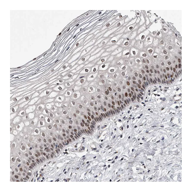 Atlas Antibodies Anti-MSL1 Antibody