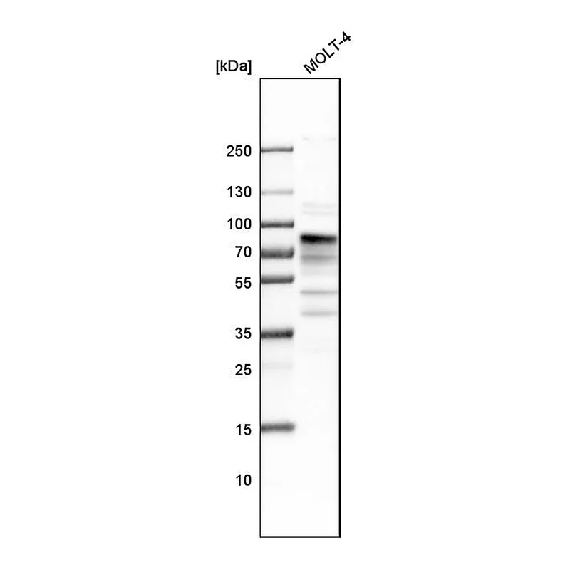 Atlas Antibodies Anti-MSL2 Antibody