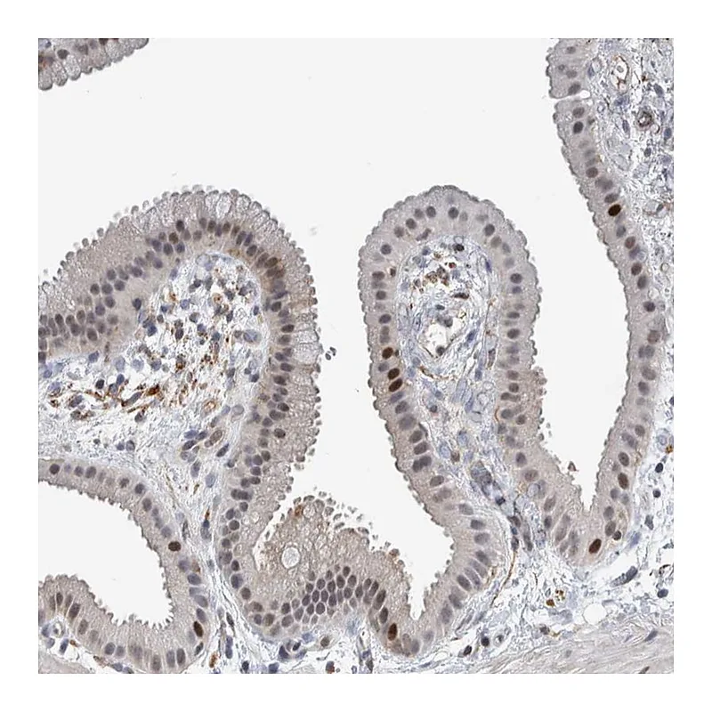 Atlas Antibodies Anti-MSL1 Antibody