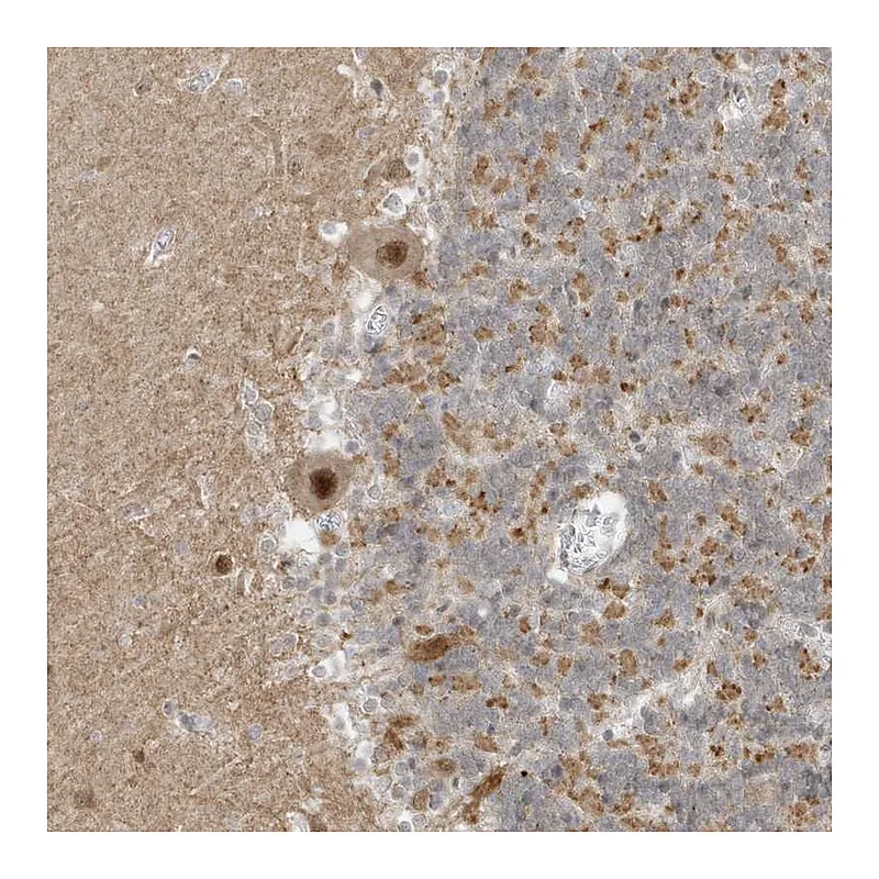 Atlas Antibodies Anti-MSL3 Antibody
