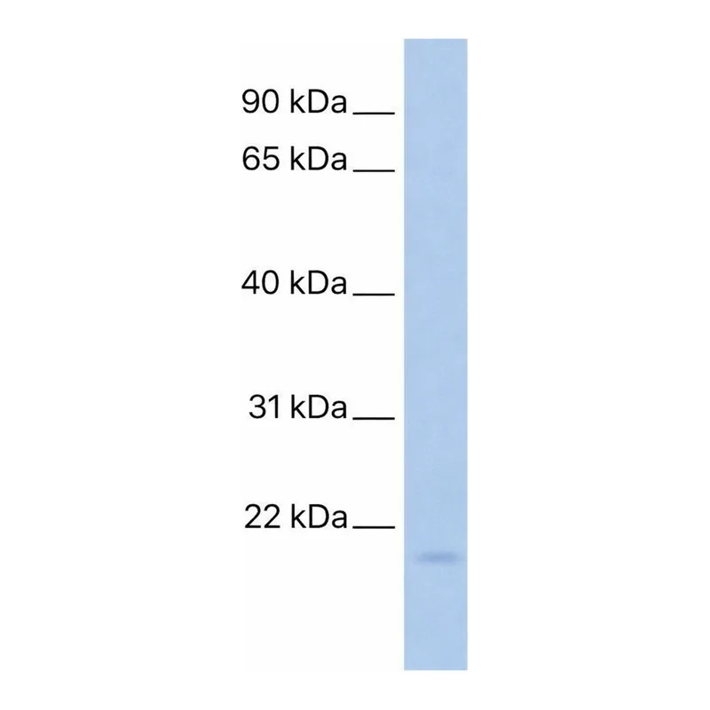 Merck Anti-TNFAIP8L1 antibody produced in rabbit