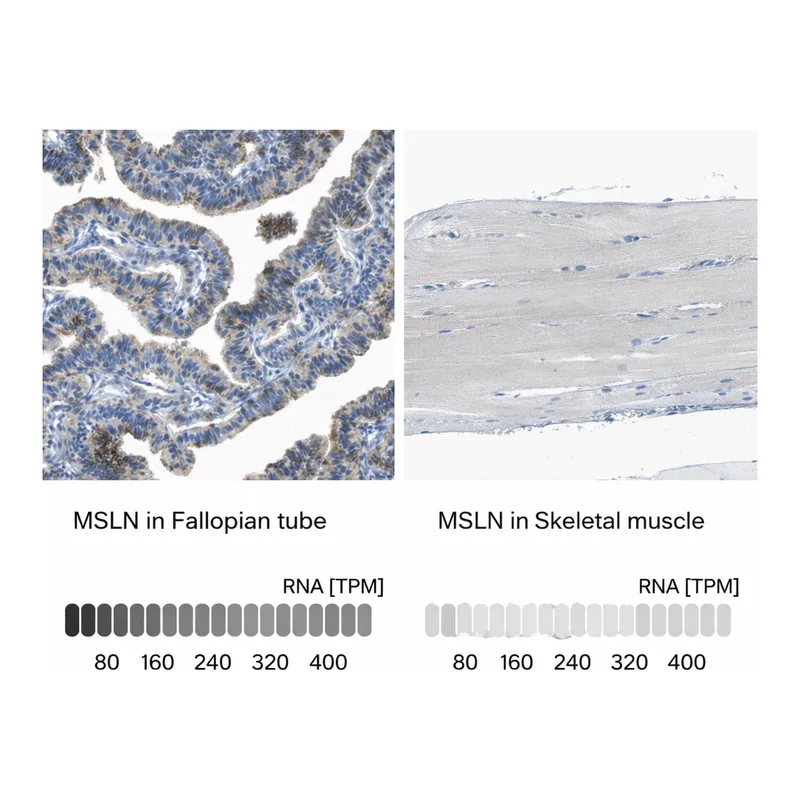 Atlas Antibodies Anti-MSLN Antibody