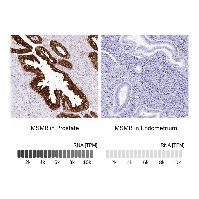Atlas Antibodies Anti-MSMB Antibody