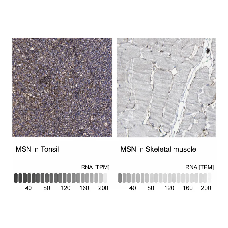 Atlas Antibodies Anti-MSN Antibody