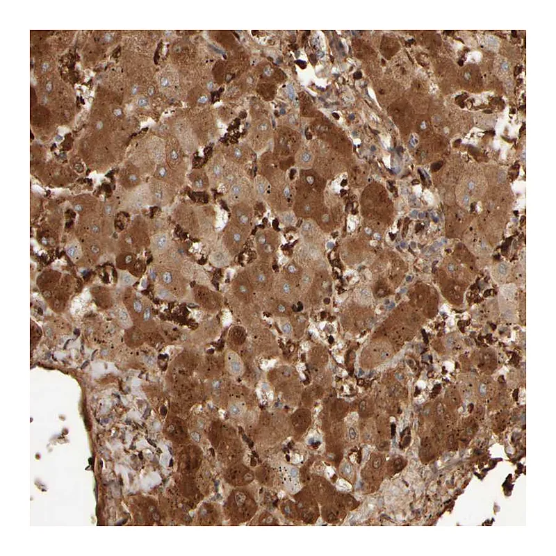 Atlas Antibodies Anti-MST1 Antibody