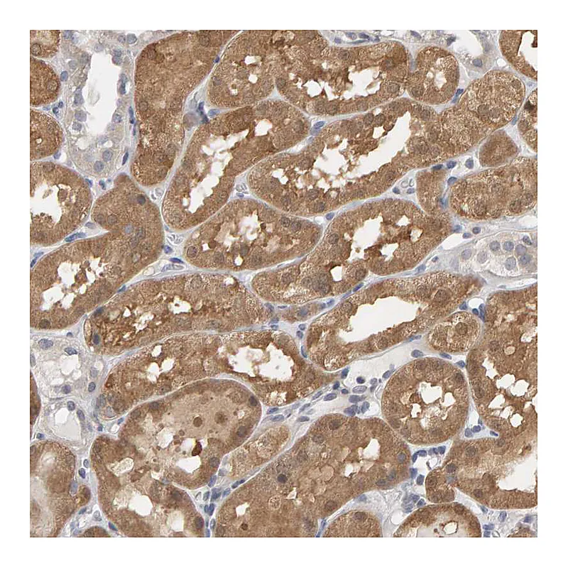 Atlas Antibodies Anti-MSRA Antibody