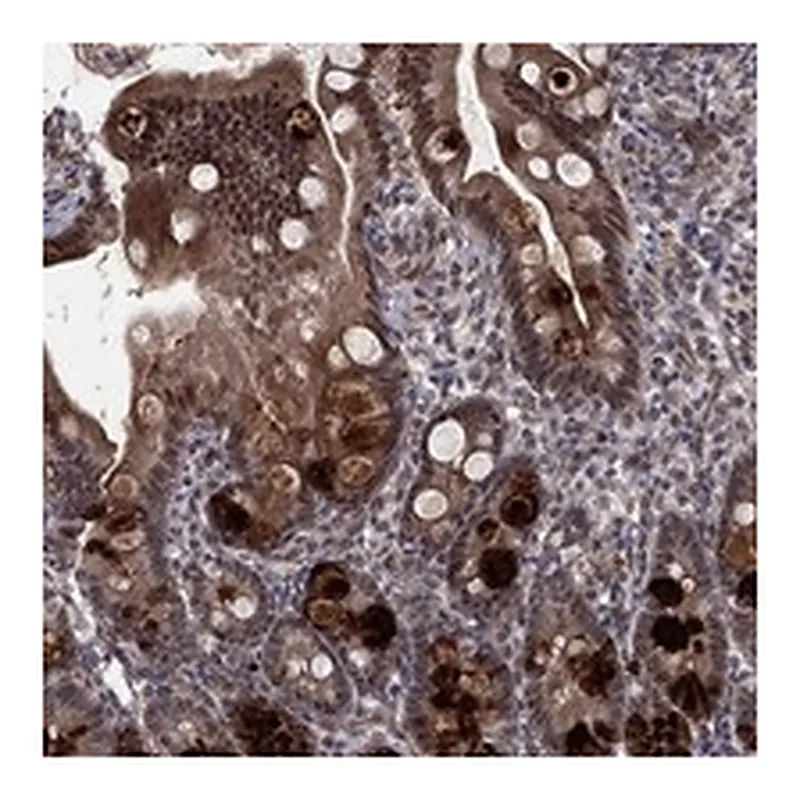 Atlas Antibodies Anti-MSRA Antibody