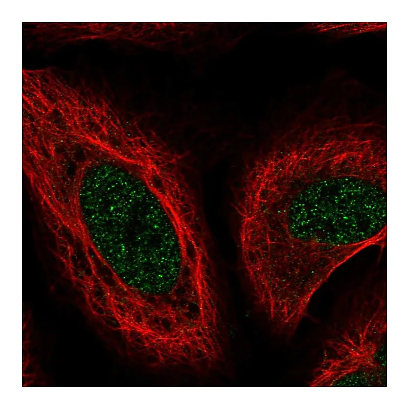 Atlas Antibodies Anti-MSRB1 Antibody