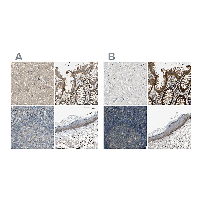Atlas Antibodies Anti-MST1R Antibody