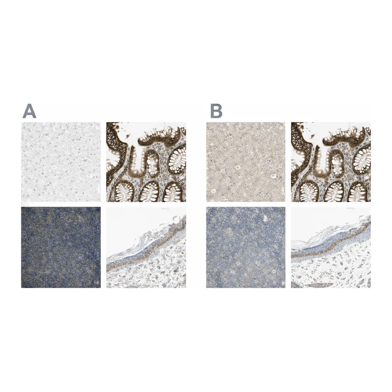 Atlas Antibodies Anti-MST1R Antibody