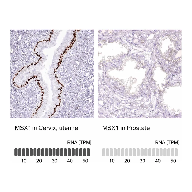 Atlas Antibodies Anti-MSX1 Antibody