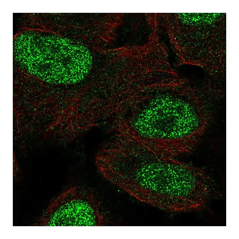 Atlas Antibodies Anti-MSX1 Antibody