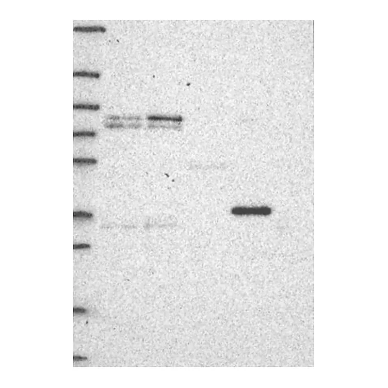 Atlas Antibodies Anti-MT-CYB Antibody