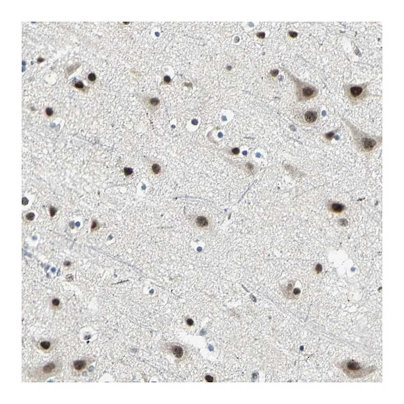 Atlas Antibodies Anti-MTA1 Antibody