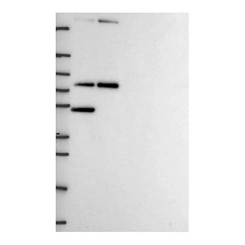 Atlas Antibodies Anti-MTA2 Antibody