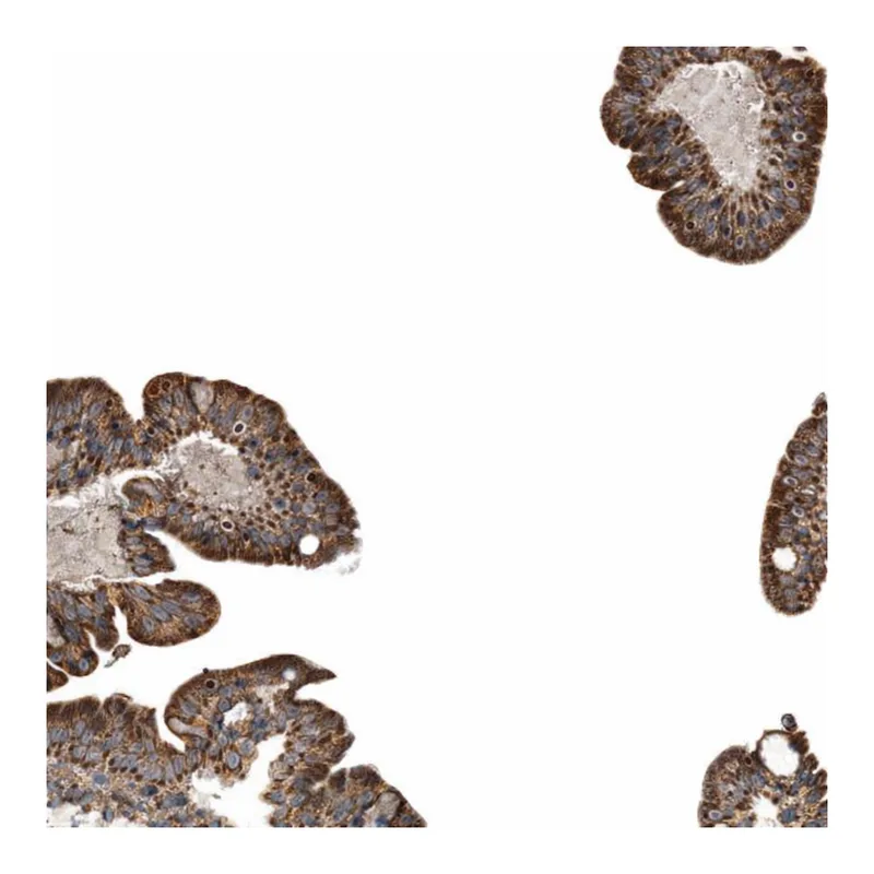 Atlas Antibodies Anti-MTCH1 Antibody