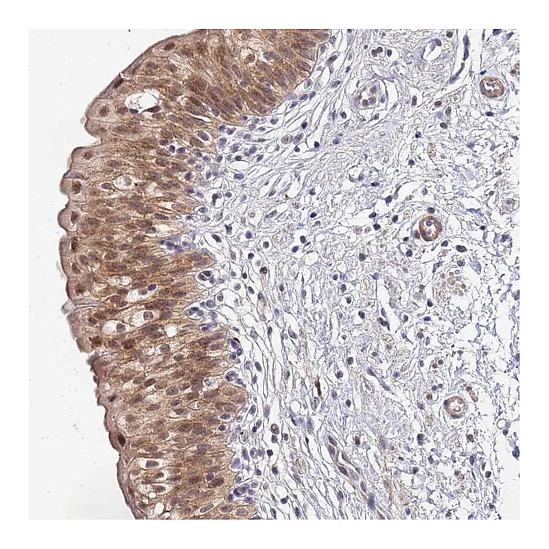 Atlas Antibodies Anti-MTCL1 Antibody