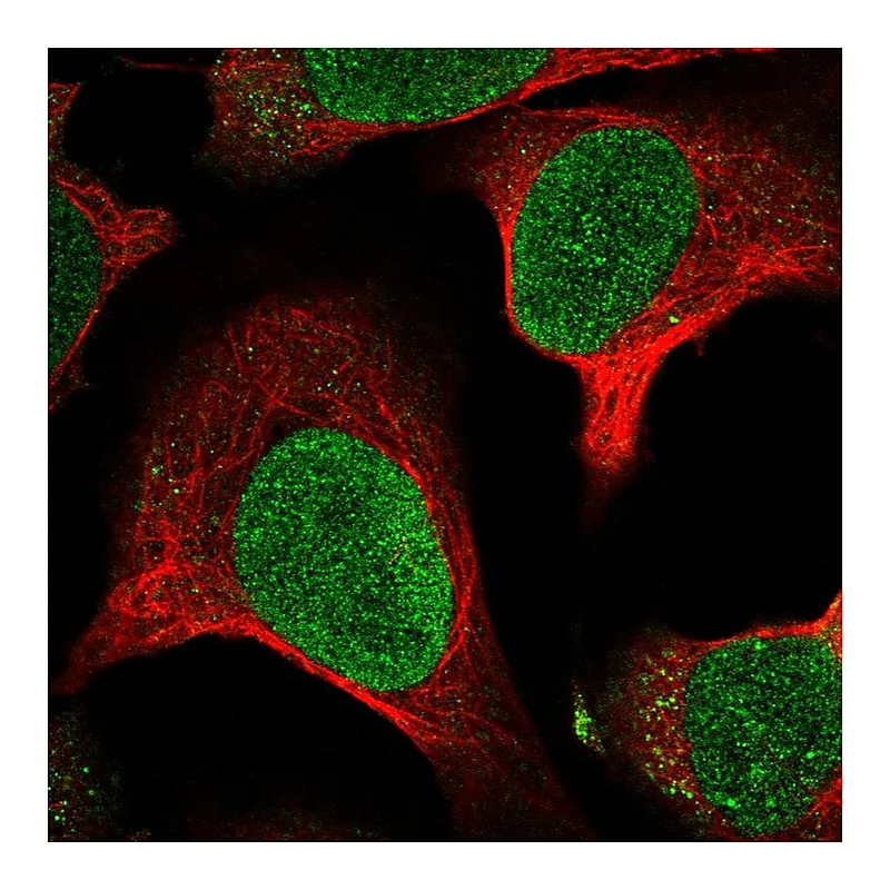 Atlas Antibodies Anti-MTBP Antibody