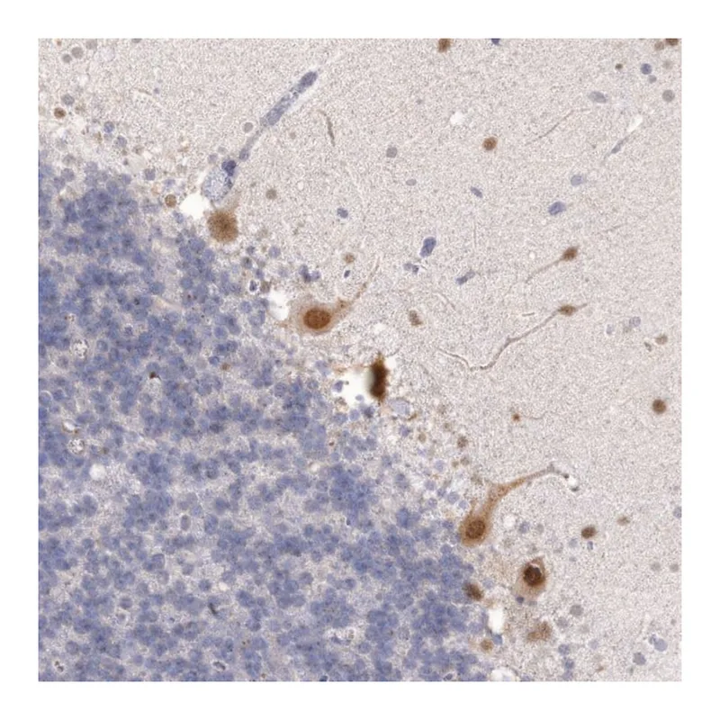Atlas Antibodies Anti-MTBP Antibody