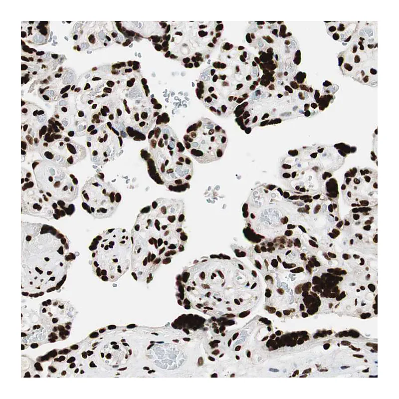Atlas Antibodies Anti-MTA2 Antibody
