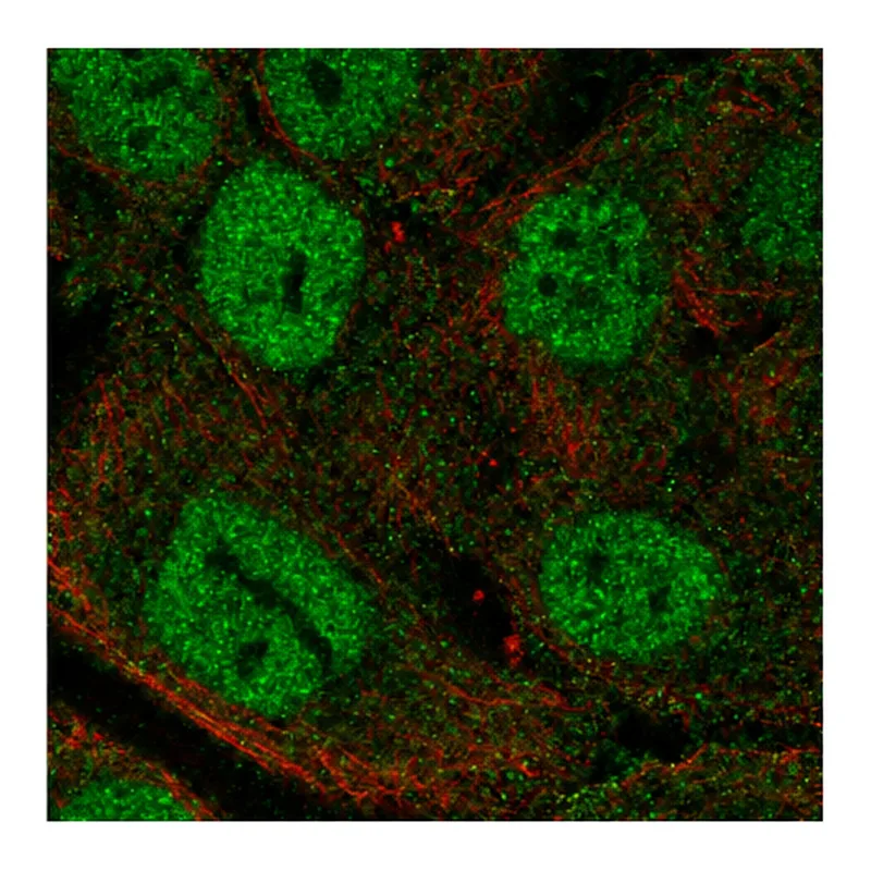Atlas Antibodies Anti-MTCP1 Antibody