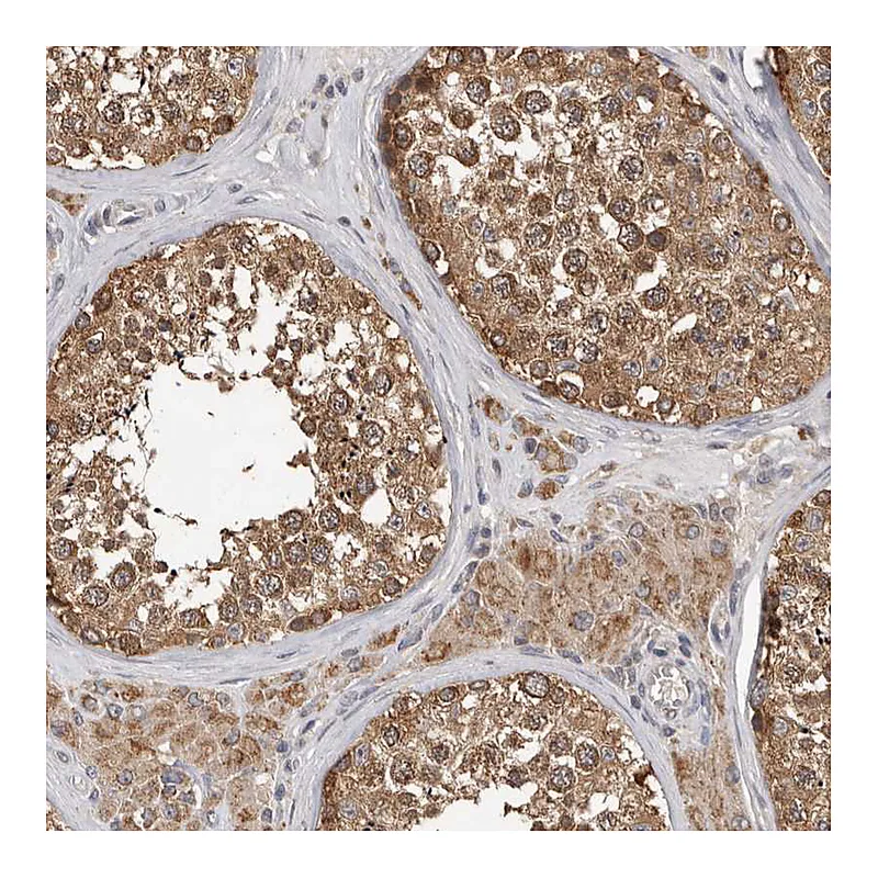 Atlas Antibodies Anti-MTF1 Antibody