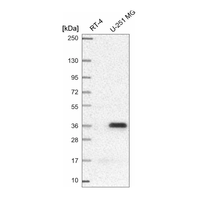 Atlas Antibodies Anti-MTERF1 Antibody